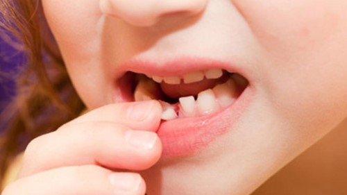 Giải mã giấc mơ rụng răng: Giấc mơ rụng răng có thật sự đáng sợ?